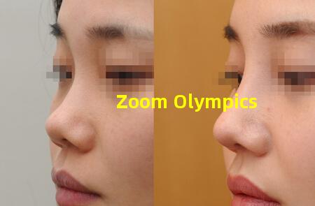 Zoom Olympics
